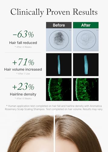 Rosemary Scalp Scaling Shampoo for Hair Growth (13.53 Fl Oz)