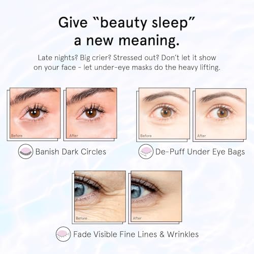 Retinol Under Eye Patches for Puffy Eyes (6 Count)