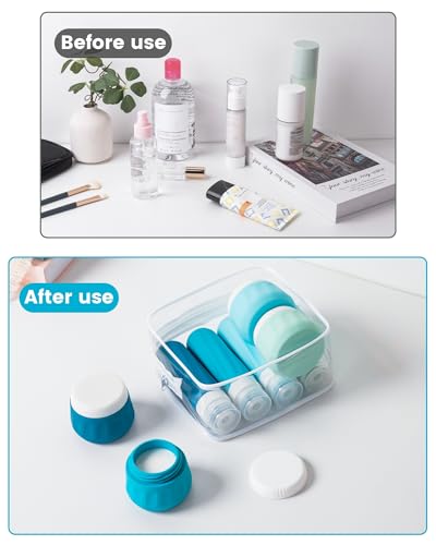 Travel Size Toiletries 8 Pack (8 Count)