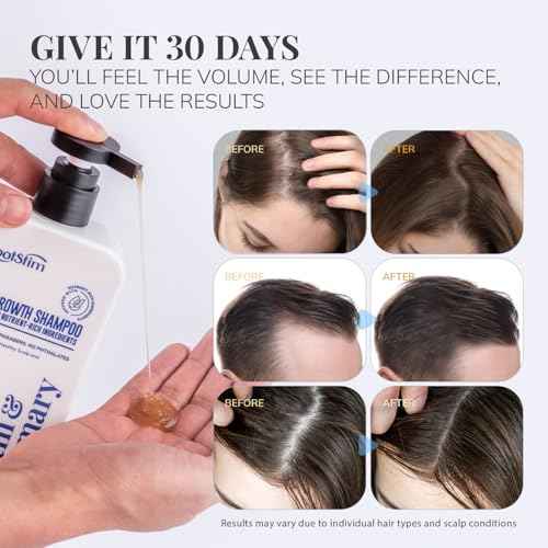 Biotin & Rosemary Hair Growth Shampoo for Thinning Hair (20 Fl Oz)