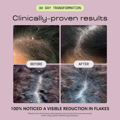 Anti Dandruff Shampoo (31.4 Fl Oz)