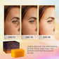 Kojic Acid Dark Spot Remover Soap Bars (7 Ounce)