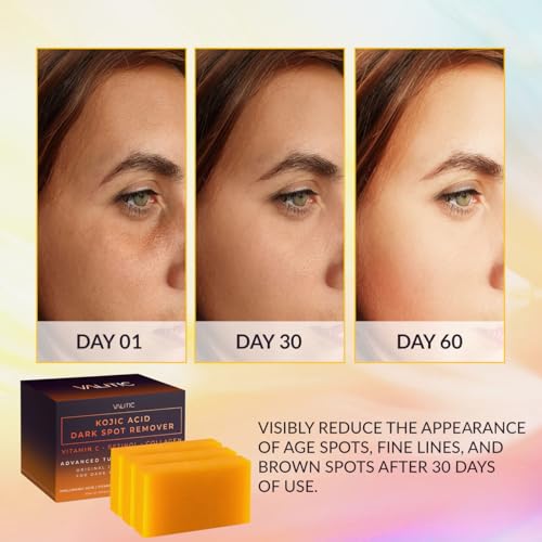 Kojic Acid Dark Spot Remover Soap Bars (10.5 Ounce)