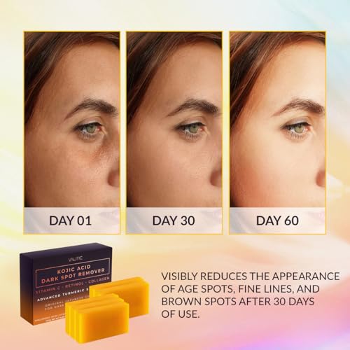 Kojic Acid Dark Spot Remover Soap Bars (17.6 Ounce)