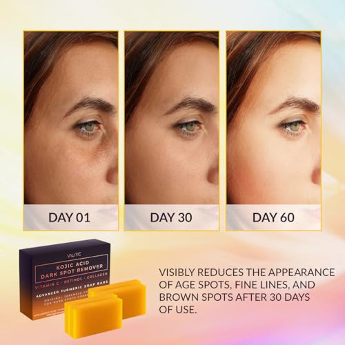 Kojic Acid Dark Spot Remover Soap Bars (14.08 Ounce)